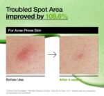 Anua Azelaic Acid 10 Hyaluron Redness Soothing Serum, Facial Serum for Troubled & Sensitive Skin, Breakouts, Hyaluronic Acid, Niacinamide, Spot Care, Natural Color, Korean Skincare (30ml/ 1.01 fl oz.) - Image 5